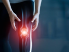 What Is the Most Common Type of Knee Injury?